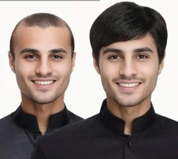 Before and after of a man wearing a natural hair system