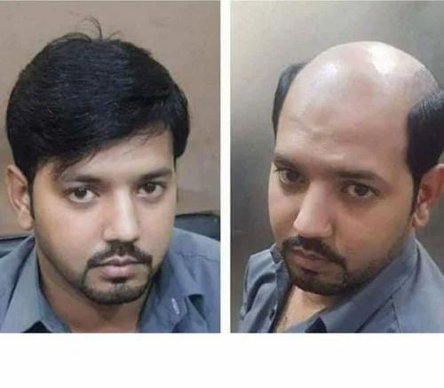 Before and after in a blue shirt
