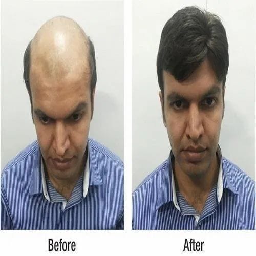 Before and after labeled comparison