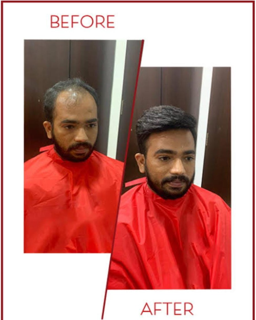 Before and after in a salon cape